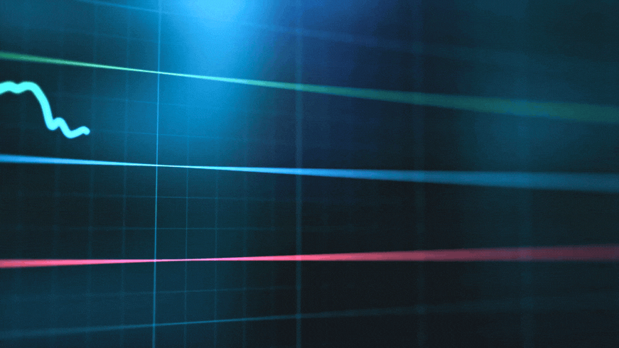 How to understand options trading before you start